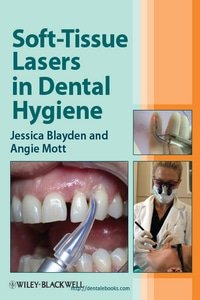 Soft‐Tissue Lasers in Dental Hygiene