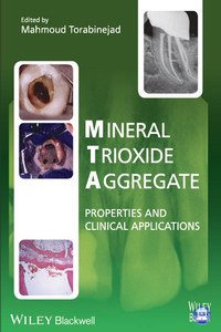 Mineral Trioxide Aggregate: Properties and Clinical Applications