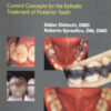 Adhesive Metal-Free Restorations: Current Concepts for the Esthetic Treatment of Posterior Teeth