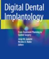 Digital Dental Implantology: From Treatment Planning to Guided Surgery