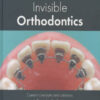 Invisible Orthodontics: Current Concepts and Solutions in Lingual Orthodontics Invisible Orthodontics