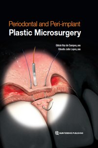 Periodontal and Peri-implant Plastic Microsurgery