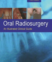 Oral Radiosurgery: An Illustrated Clinical Guide, 3rd Edition