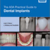 The ADA Practical Guide to Dental Implants The ADA Practical Guide to Dental Implants