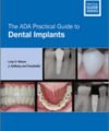 The ADA Practical Guide to Dental Implants