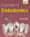 Essentials of Endodontics, 2nd Edition