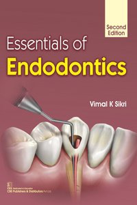 Essentials of Endodontics, 2nd Edition