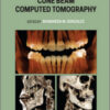 Interpretation Basics of Cone Beam Computed Tomography, 2nd Edition Interpretation Basics of Cone Beam Computed Tomography, 2nd Edition