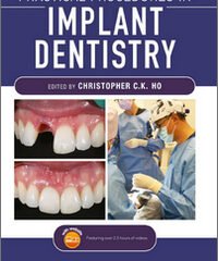 Practical Procedures in Implant Dentistry
