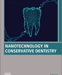 Nanotechnology in Conservative Dentistry