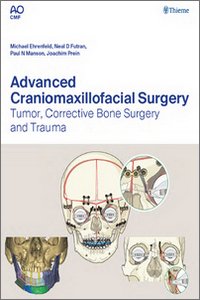 Advanced Craniomaxillofacial Surgery: Tumor, Corrective Bone Surgery and Trauma