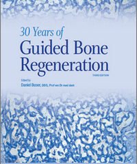 30 Years of Guided Bone Regeneration, 3rd Edition