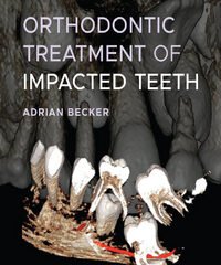 Orthodontic Treatment of Impacted Teeth, 4th Edition