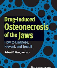 Drug-Induced Osteonecrosis of the Jaws: How to Diagnose, Prevent, and Treat It