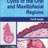 Shear’s Cysts of the Oral and Maxillofacial Regions, 5th Edition Shear's Cysts of the Oral and Maxillofacial Regions, 5th Edition