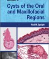 Shear's Cysts of the Oral and Maxillofacial Regions, 5th Edition