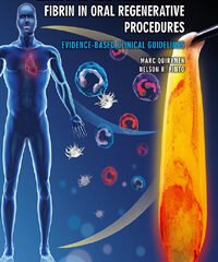 Leukocyte- and Platelet-Rich Fibrin in Oral Regenerative Procedures: Evidence-Based Clinical Guidelines