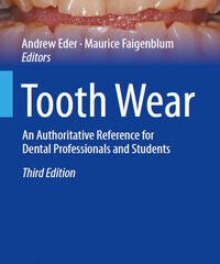 Tooth Wear: An Authoritative Reference for Dental Professionals and Students, 3rd Edition (BDJ Clinician’s Guides)