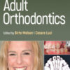 Adult Orthodontics, 2nd Edition