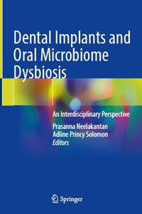 Dental Implants and Oral Microbiome Dysbiosis: An Interdisciplinary Perspective