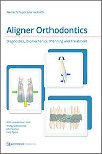 Aligner Orthodontics_Diagnostics, Biomechanics, Planning, and Treatment