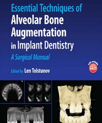 Essential Techniques of Alveolar Bone Augmentation in Implant Dentistry: A Surgical Manual, 2nd Edition
