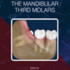 Transalveolar Extraction of the Mandibular Third Molars Transalveolar Extraction of the Mandibular Third Molars