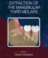 Transalveolar Extraction of the Mandibular Third Molars