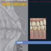 Specialty Imaging: Dental Implants, 1st Edition Specialty Imaging: Dental Implants, 1st Edition