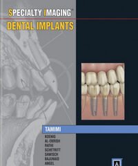 Specialty Imaging: Dental Implants, 1st Edition