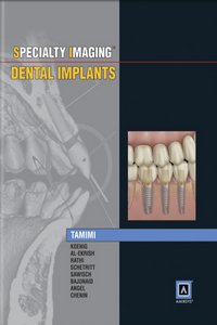 Specialty Imaging: Dental Implants, 1st Edition