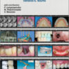 Introduction to Implant Prosthodontics: A Case-Based Clinical Guide Introduction to Implant Prosthodontics: A Case-Based Clinical Guide