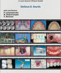 Introduction to Implant Prosthodontics: A Case-Based Clinical Guide