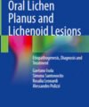 Oral Lichen Planus and Lichenoid Lesions: Etiopathogenesis, Diagnosis and Treatment
