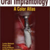 Treatment Planning Steps in Oral Implantology: A Color Atlas Treatment Planning Steps in Oral Implantology: A Color Atlas