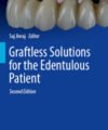 Graftless Solutions for the Edentulous Patient, 2nd Edition