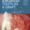 Bone Regeneration in Implantology: Tooth as a Graft Bone Regeneration in Implantology: Tooth as a Graft