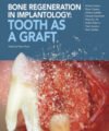 Bone Regeneration in Implantology: Tooth as a Graft