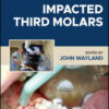 Impacted Third Molars, 2nd Edition Impacted Third Molars, 2nd Edition