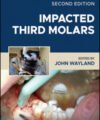 Impacted Third Molars, 2nd Edition