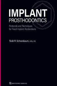 Implant Prosthodontics: Protocols and Techniques for Fixed Implant Restorations