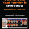 Debonding and Fixed Retention in Orthodontics: An Evidence-Based Clinical Guide Debonding and Fixed Retention in Orthodontics: An Evidence-Based Clinical Guide
