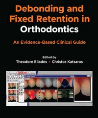Debonding and Fixed Retention in Orthodontics: An Evidence-Based Clinical Guide