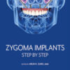 Zygoma Implants: Step by Step Zygoma Implants: Step by Step