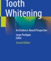 Tooth Whitening: An Evidence-Based Perspective, 2nd Edition