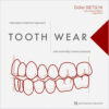 Tooth Wear: Interceptive Treatment Approach with Minimally Invasive Protocols Tooth Wear: Interceptive Treatment Approach with Minimally Invasive Protocols