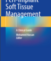 Peri-Implant Soft Tissue Management: A Clinical Guide