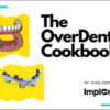 The OverDenture Cookbook (Implant Ninja) The OverDenture Cookbook (Implant Ninja)