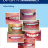 Case Guides to Complete and Partial Denture Prosthodontics Case Guides to Complete and Partial Denture Prosthodontics