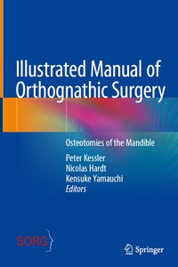 Illustrated Manual of Orthognathic Surgery: Osteotomies of the Mandible